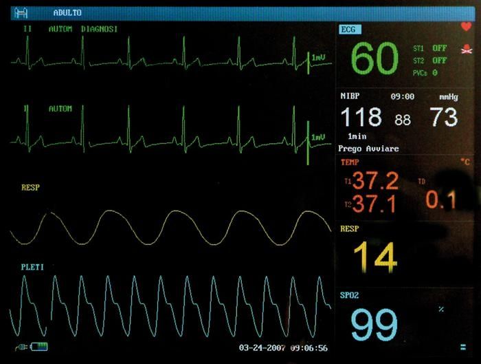monitor-multiparametrico